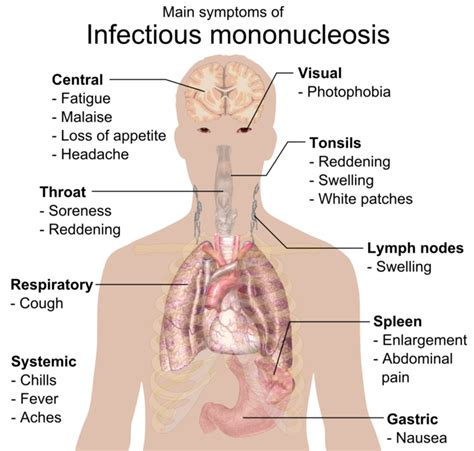 C Mononucleosis Infecciosa Libretexts Espa Ol