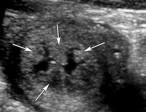 Us Of The Nongravid Cervix With Multimodality Imaging Correlation