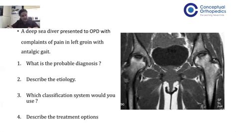 Osce Hip Examination Conceptual Orthopedics Youtube