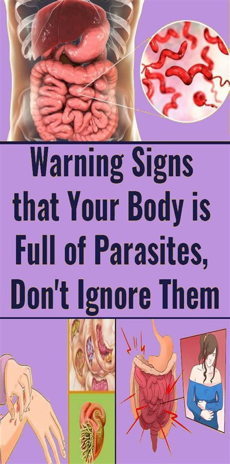 Here Are Some Signs That Point Out Towards The Presence Of Parasites In