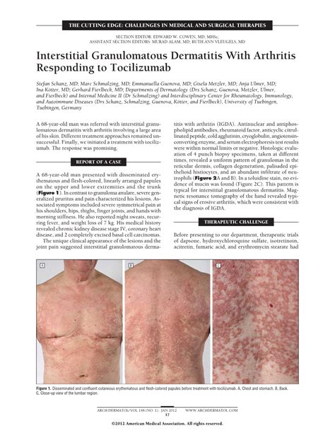 Interstitial Granulomatous Dermatitis With Arthritis Responding To