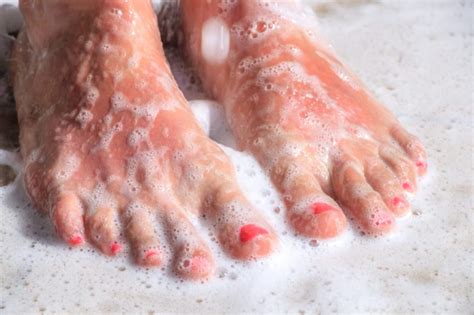 Athletes Foot Treatment Home Remedies That Work The Healthy