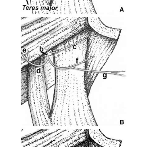 Pdf Teres Minor Innervation In The Context Of Isolated Muscle Atrophy