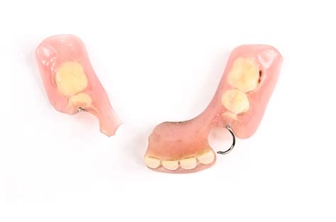 Signs Your Dentures Need To Be Replaced Charlotte Nc