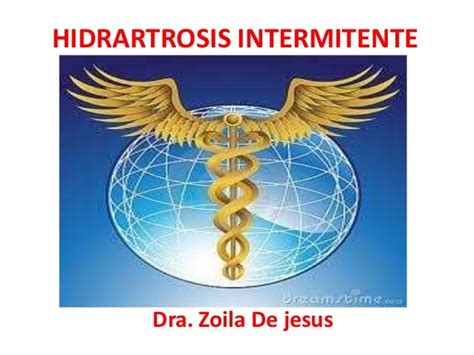 Hidrartrosis Intermitente