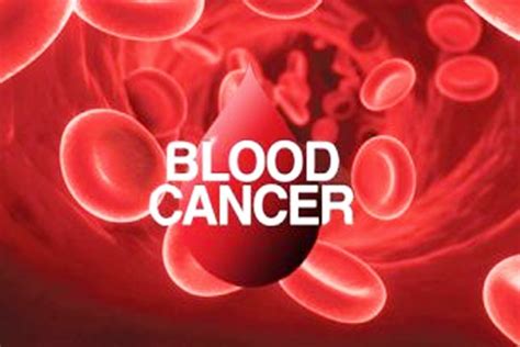 Blood Cancer Types Symptoms And Treatment Daneelyunus