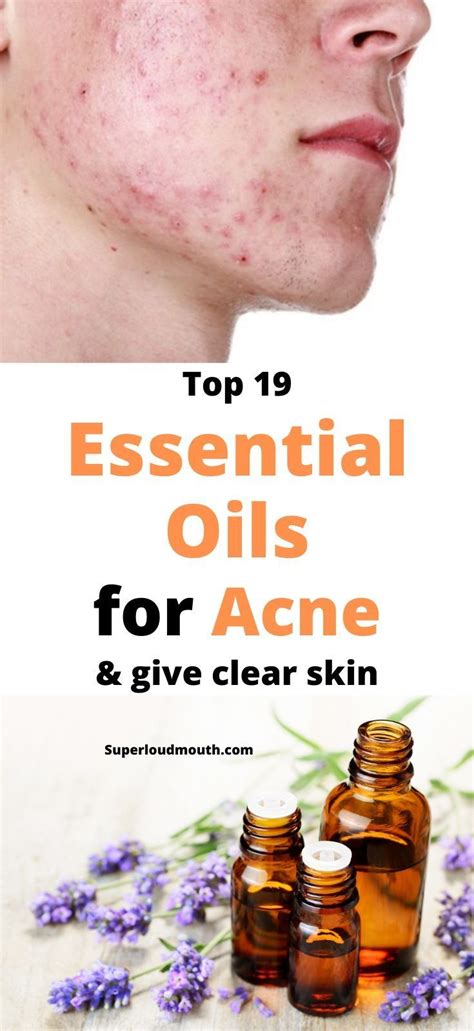 19 Most Effective Essential Oils For Acne How To Use In 2020 With Images Essential Oils
