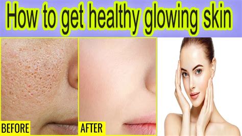 How To Get Healthy Glowing Skin 7 Tips For Healthy Skin Beauty Tips For Healthy Glowing Skin