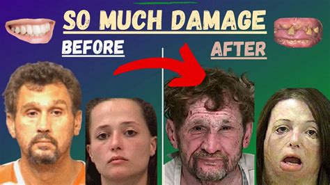 Faces Of Meth Before And After Youtube