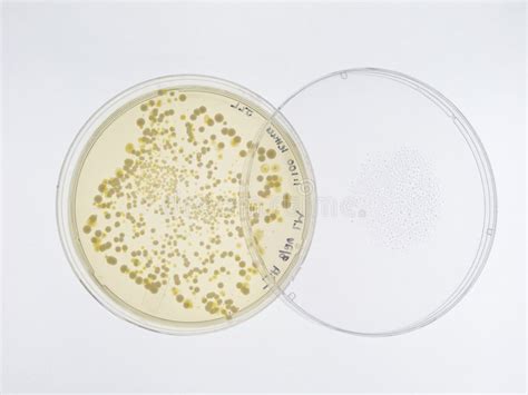 Bacterial Colonies On Agar Plate Stock Photo Image Of Cells Health
