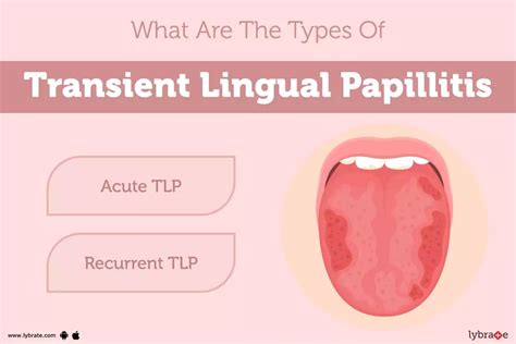 Transient Lingual Papillitis Causes Symptoms Treatment And Cost