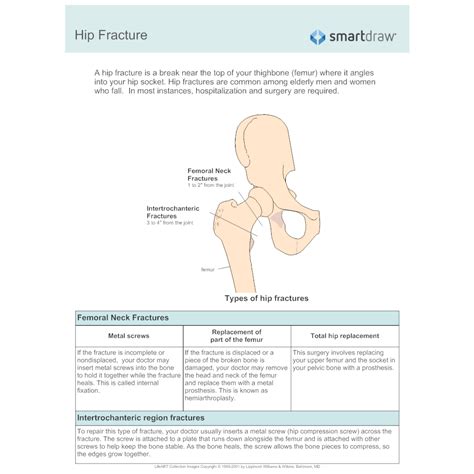 Hip Fracture 1