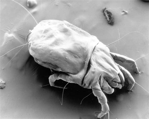 Dust Mite Allergens Activate The Pulmonary Immune System Triggering