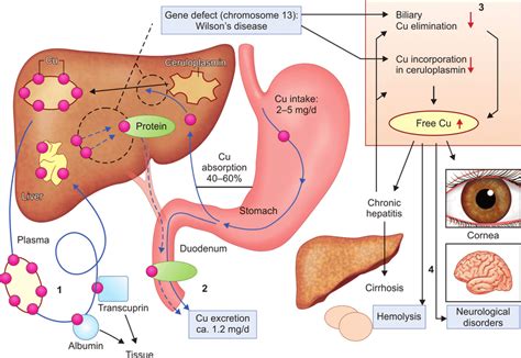 Defective Copper Metabolism And Pathogenesis Of Wilsons Disease