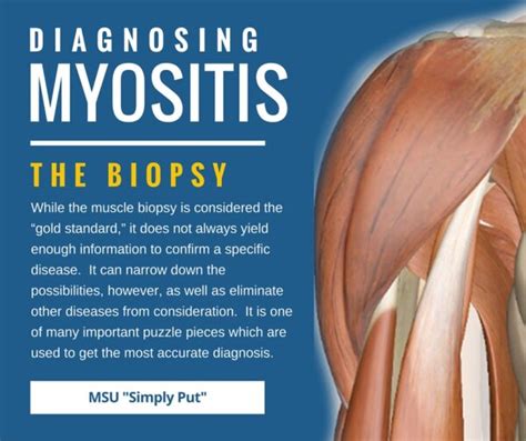 How To Diagnose Myositis Myositis Support And Understanding