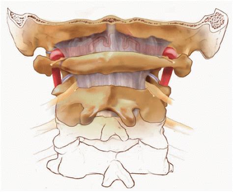 Posterior Cervical Approach Musculoskeletal Key