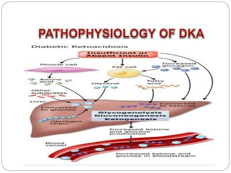 Pathophysiology Of Diabetic Ketoacidosis