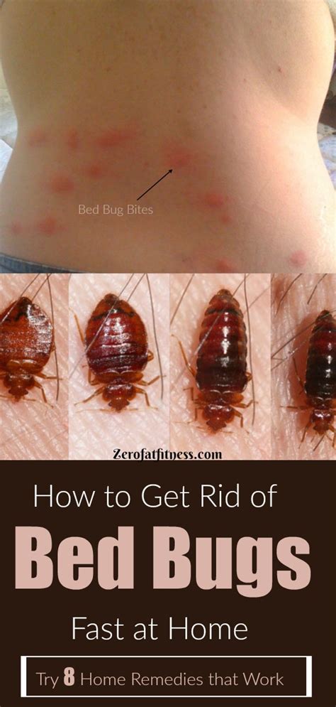 Get rid of bed bugs on your mattress: How to Get Rid of Bed Bugs Fast - 8 Home Remedies That Work