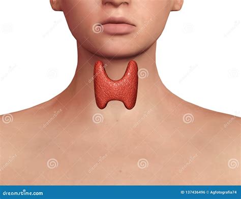 Thyroid Gland Exposed On The Neck Of A Woman With Endocrine Disruption