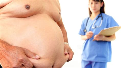 Bariatric Surgery Morbid Obesity Overview Dr Anastasios
