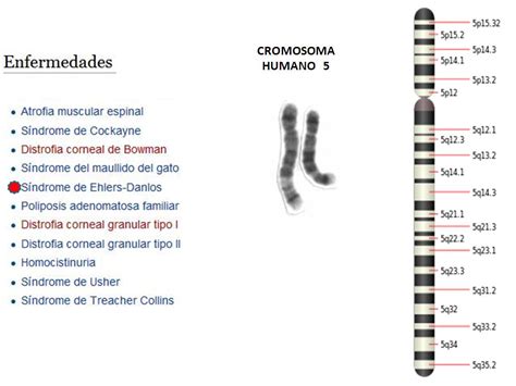 Ehlers Danlos Enlaces Argentina Genes Y Cromosomas En El Ehlers Danlos
