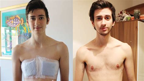 What Its Really Like To Have Female To Male Gender Reassignment