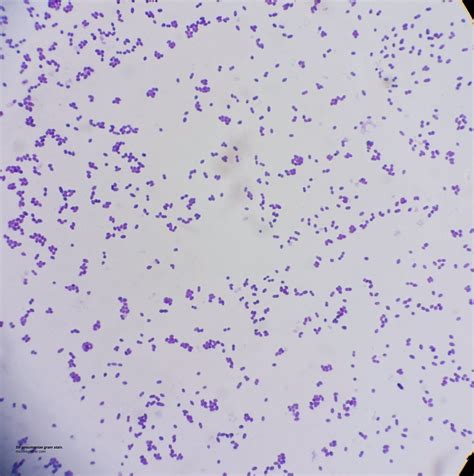 A microbial biorealm page on the genus streptococcus pneumoniae. Streptococcus pneumoniae (Pneumococcus) | microregistrar ...