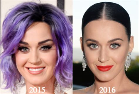 Katy Perry Plastic Surgery Before And After Photos Latest Plastic Surgery Gossip And News