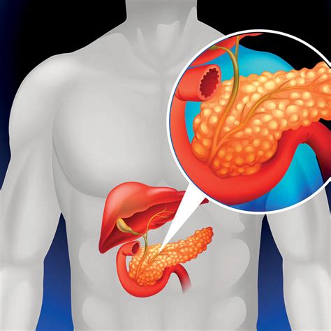 Cancer sign/libra rising isn't the most comfortable combination. Pancreatic cancer patients survive longer at major cancer ...