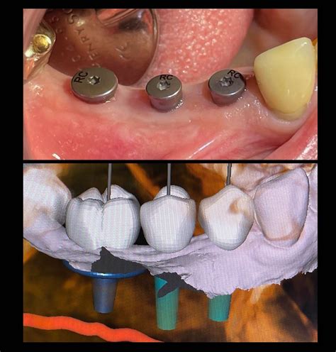 Faq David C Stahr Dds Oral Surgery — Stahr Oral Surgery