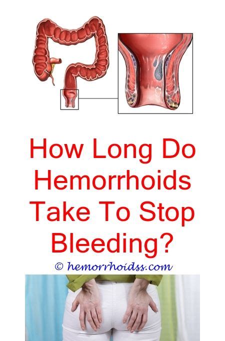 Why Are External Hemorrhoids Itchy What To Do If Your Hemorrhoids