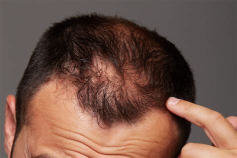 Você sente dor no couro cabeludo Veja o que pode ser Clínica de Tratamento Capilar Cabelo e