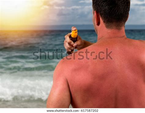 Man Sunburned Skin Ocean Beach Sunset Stock Photo Edit Now 617587202