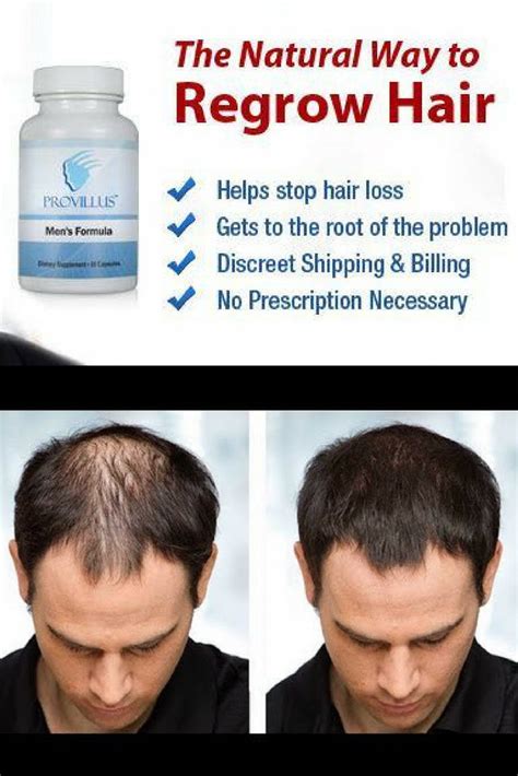 Is It Possible To Regrow Hair On Bald Head Naturally Favorite Men