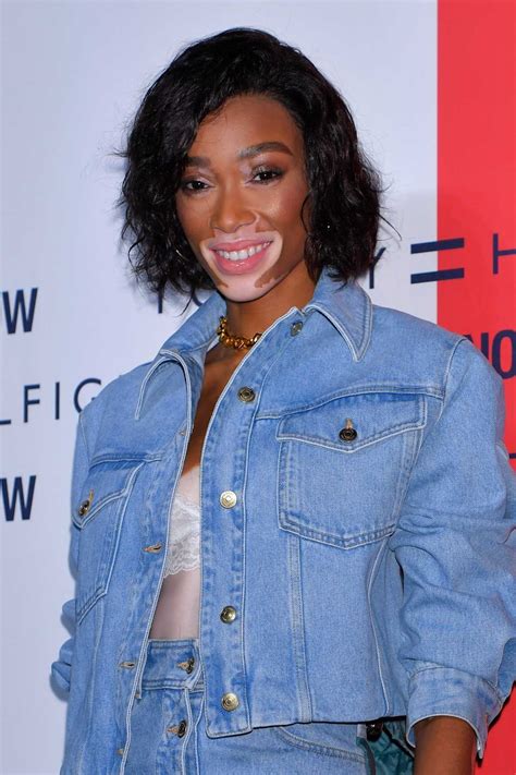 Winnie Harlow Attends The Photocall For Tommy Hilfiger Presents Tokyo