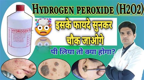 Hydrogen Peroxide Uses Hydrogen Peroxide Ear Wax Removal Hydrogen