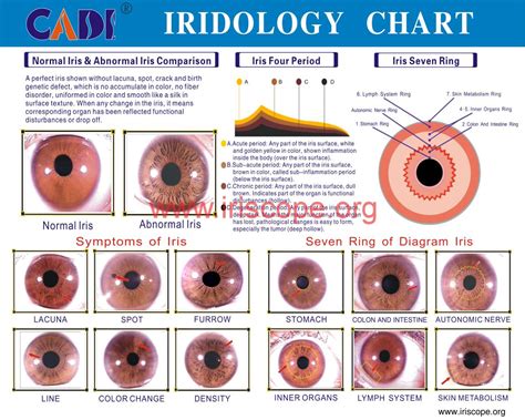 The 10 Best Chart For Iridology Eye Chart Iriscope Iridology Camera