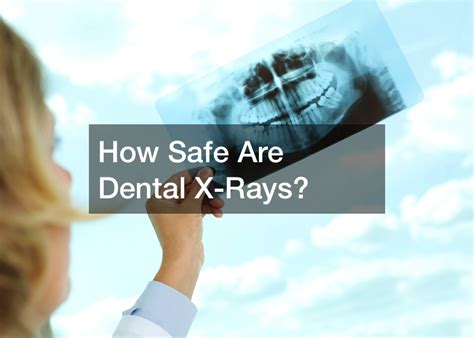 How Safe Are Dental X Rays Free Health Videos