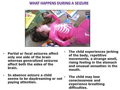 Symptoms Of Seizures In Children Dr Habib Pathan Explains