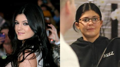 Kylie Jenner With Smaller Lips Looks Like Teenage Self In New Pics