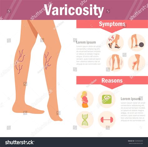 22 Causes Of Phlebitis Images Stock Photos And Vectors Shutterstock