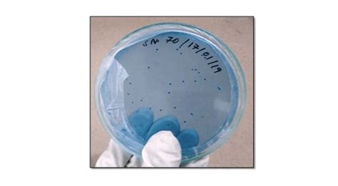 Streptococcus Mutans Y Streptococcus Sobrinus En Muestras De Placa