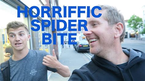 Horrific Spider Bite Youtube