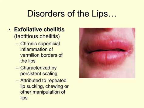 Ppt Disorders Of Oral Cavity Powerpoint Presentation Free Download
