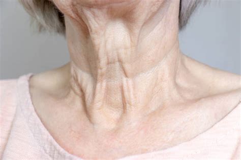 Dr Rachel Ho How To Get Rid Of Neck Lines And Wrinkles