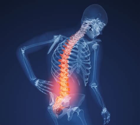 How Physical Therapy Can Help Back Pain
