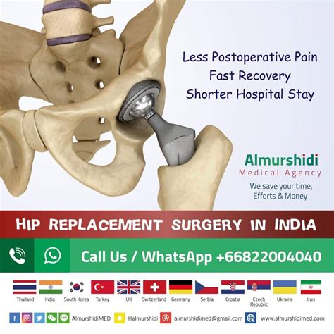 Total Hip Arthroplasty Or Total Hip Replacement Surgery In India
