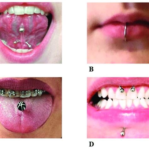 Different Locations For Oral Piercing Include A The Lingual Frenulum Download Scientific