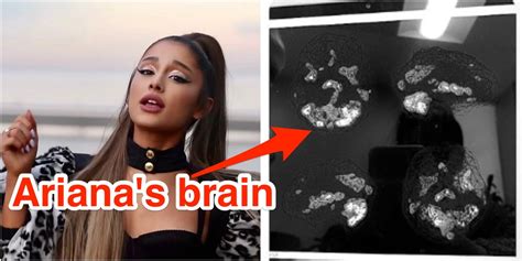Ariana Grande Says Terrifying Brain Scan Shows Her Ptsd