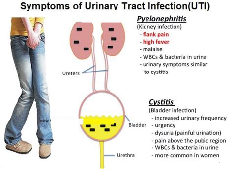 The 24 Hour Mommy Fighting Urinary Tract Infection Uti